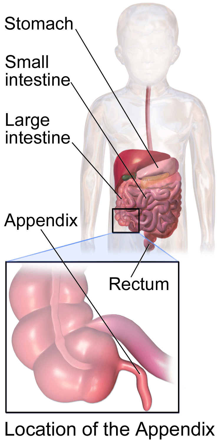 Lado direito do abdome: o apêndice é uma bolsa presa ao intestino grosso — é aí que a inflamação da apendicite começa.