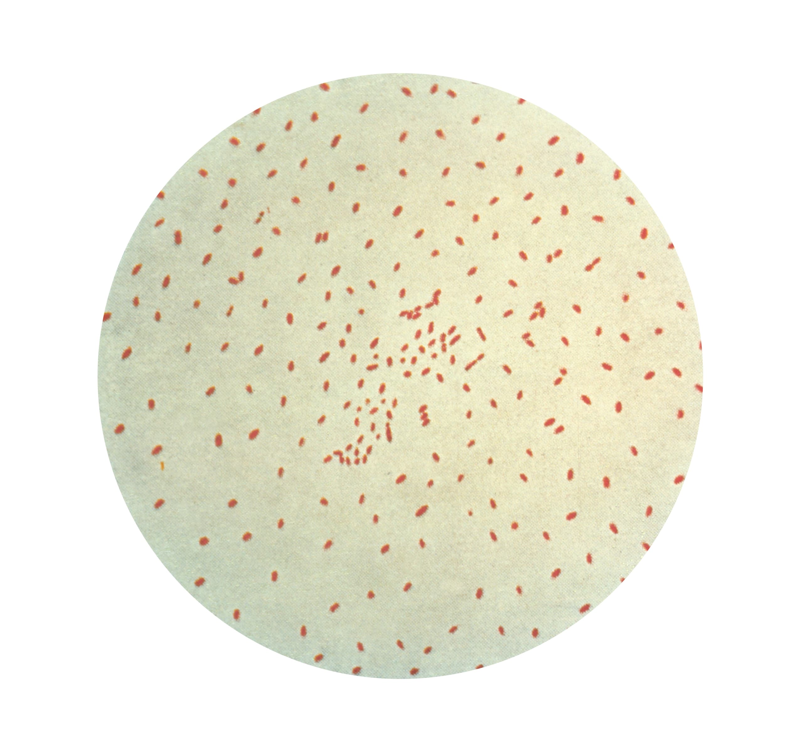 Bordetella pertussis, a bactéria causadora da coqueluche, vista ao microscópio após coloração de Gram.