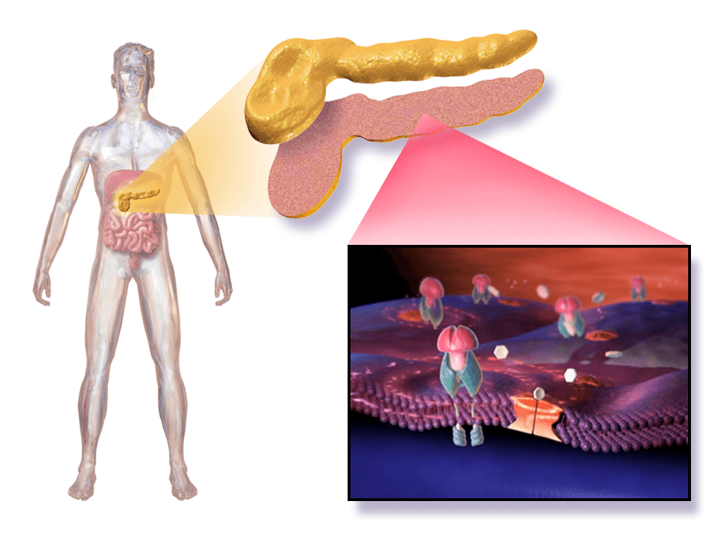 O pâncreas produz a insulina que abre as células para a glicose entrar. No diabetes tipo 2, esse mecanismo funciona mal e a glicose se acumula no sangue.